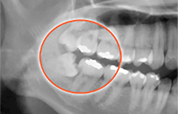 横向きに生えている