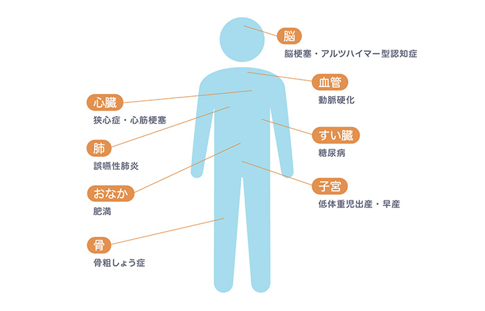むし歯と歯周病を予防して全身の疾患を予防